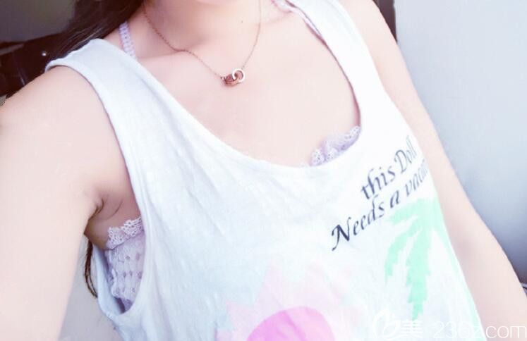 找合肥福华整形赵章杰做自体脂肪丰胸前 找合肥福华整形赵章杰做自体脂肪丰胸前