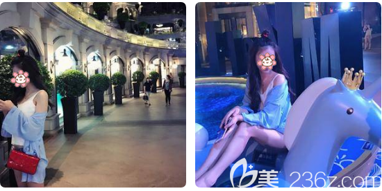 广州中家医家庭医生大腿吸脂一个月术后 广州中家医家庭医生大腿吸脂一个月术后