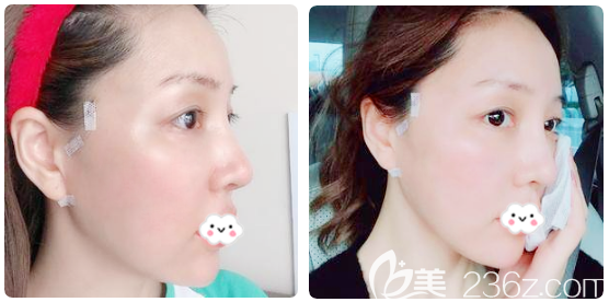 韩国优雅斯<span style=