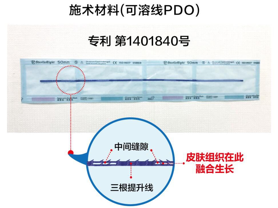 韩国profile医院朴明旭院长线雕核心技术