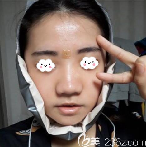 韩国EU颌面轮廓整形双颚手术矫正突嘴