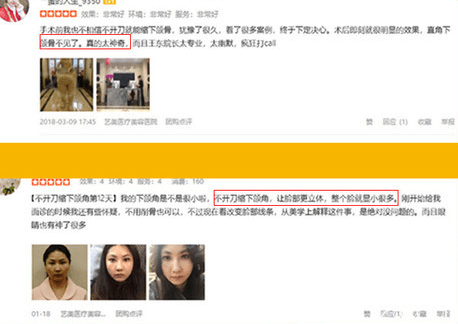 在北京艺美做过改脸型的爱美者口碑评价展示
