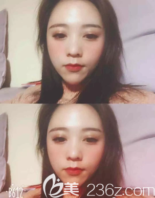 一个礼拜后的样子