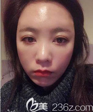 罗<!--<i data=20240703-sp></i>-->主任给我手术第二天