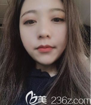 罗<!--<i data=20240703-sp></i>-->做脂肪填充好吗