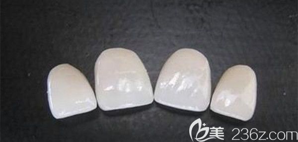 瓷贴面后需要注意的事项