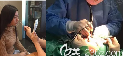 我在北京艺星做祛眼袋当天面诊和手术照