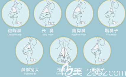 不理想的鼻子类型
