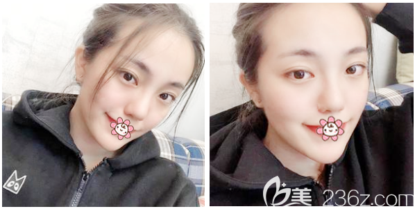 来看<!--<i data=20240703-sp></i>-->整形医院割双眼皮怎么样 来看<!--<i data=20240703-sp></i>-->整形医院割双眼皮怎么样