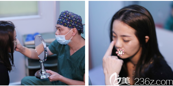 在<!--<i data=20240703-sp></i>-->整形医院割双眼皮术前照片 在<!--<i data=20240703-sp></i>-->整形医院割双眼皮术前照片