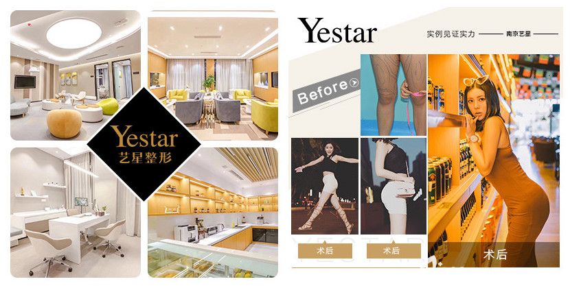 南京艺星环境和吸脂案例 南京艺星环境和吸脂案例