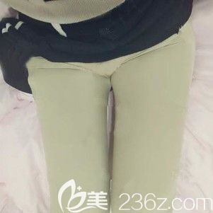 术后三天大腿吸脂的恢复情况 术后三天大腿吸脂的恢复情况