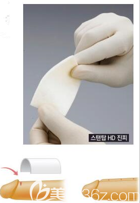 真皮生物补片的移植