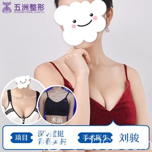 刘俊院长做深V动感丰胸术后胸部挺拔丰满 刘俊院长做深V动感丰胸术后胸部挺拔丰满