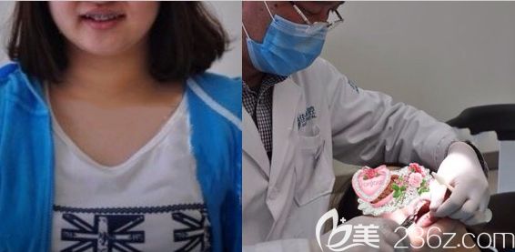 在无锡佳士洁口腔做金属牙套矫正过程图