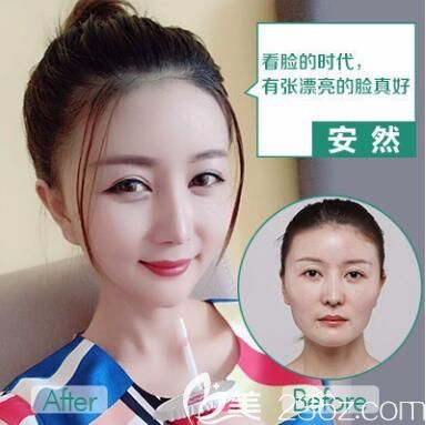 重庆华美做下颌角怎么样