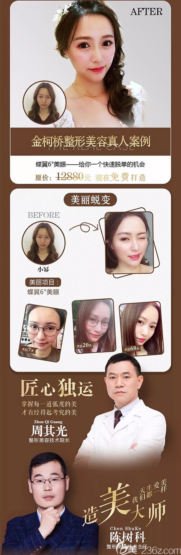 金柯桥整形蝶翼六度美眼案例效果