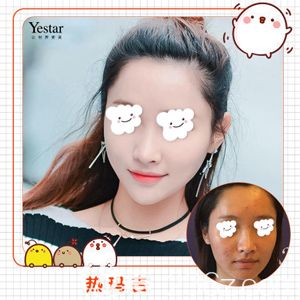 武汉艺星做热玛吉术后紧致肌肤淡化细纹 武汉艺星做热玛吉术后紧致肌肤淡化细纹