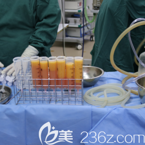 于晓春医生给我做自体脂肪丰胸手术当天照 于晓春医生给我做自体脂肪丰胸手术当天照