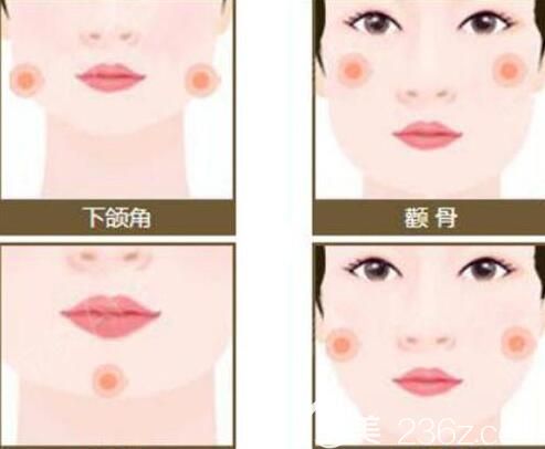 面部吸脂分几个部位