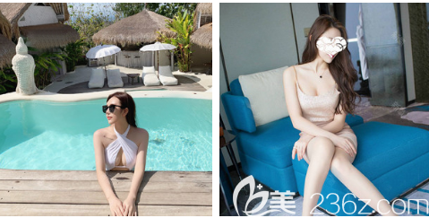 自体脂肪隆胸术后两个月恢复过程图片 自体脂肪隆胸术后两个月恢复过程图片