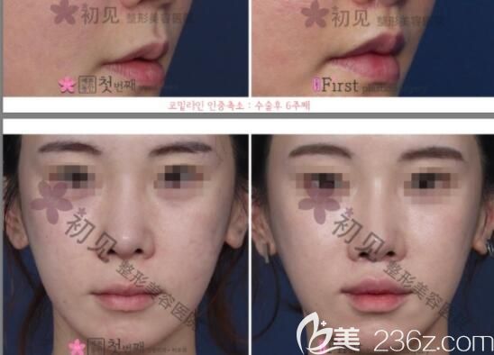 20190710_1562729917458147.jpg 20190710_1562729917458147.jpg