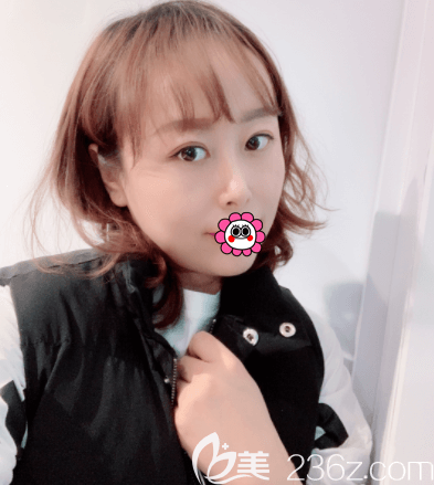 北京惠合嘉美眼综合案例 北京惠合嘉美眼综合案例