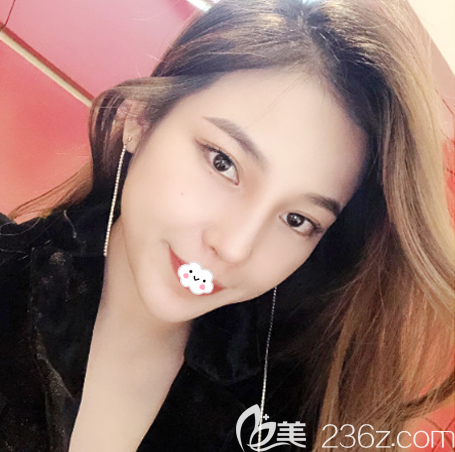 深圳美莱梁志为做隆鼻修复怎么样