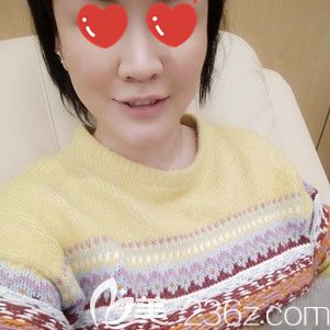 杨国梁院长帮我做自体脂肪面部填充术后面部肿胀 杨国梁院长帮我做自体脂肪面部填充术后面部肿胀