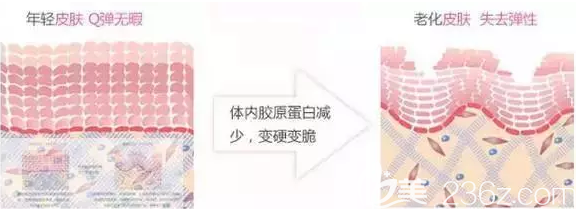 年轻肌肤与老化肌肤对比