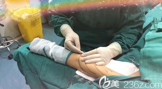 在合肥艺星整形做吸脂瘦手臂术前打麻药 在合肥艺星整形做吸脂瘦手臂术前打麻药