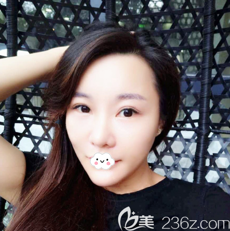 广州星团医美童颜术效果怎么样 广州星团医美童颜术效果怎么样