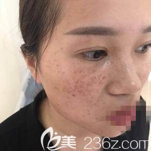 到医院以后就先面诊 到医院以后就先面诊