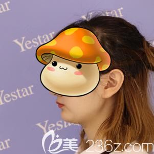 到武汉艺星做假体垫下巴术前自己的短下颌 到武汉艺星做假体垫下巴术前自己的短下颌