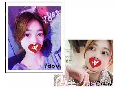 在辽宁<span style= 在辽宁<span style=