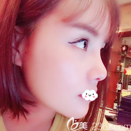 东莞壹加壹整形美容医院做隆鼻效果怎么样 东莞壹加壹整形美容医院做隆鼻效果怎么样