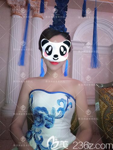 李成辉医生为我做曼托假体隆胸术后1个月胸部丰满挺拔 李成辉医生为我做曼托假体隆胸术后1个月胸部丰满挺拔