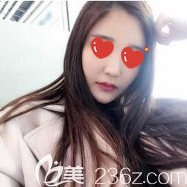 做玻尿酸全面部填充术后15天恢复效果 做玻尿酸全面部填充术后15天恢复效果