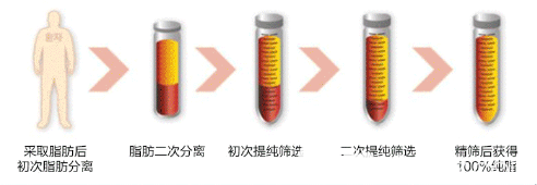 广州紫馨梁进华医生自体脂肪萃取技术优势 广州紫馨梁进华医生自体脂肪萃取技术优势