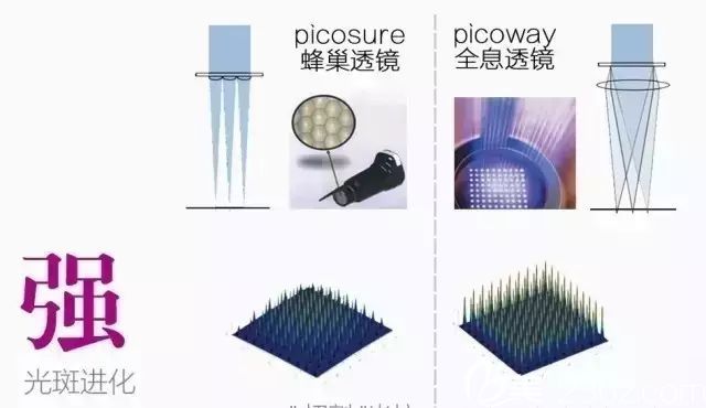 Picoway超皮秒祛斑优势