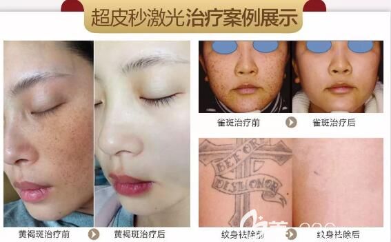 7.29-31到无锡坤如玛丽还可享受全脸美白1980元的特惠价格 7.29-31到无锡坤如玛丽还可享受全脸美白1980元的特惠价格