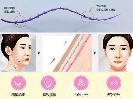 面部线雕多少岁做合适？