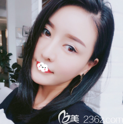 看深圳美莱梁晓健鼻子做得怎么样