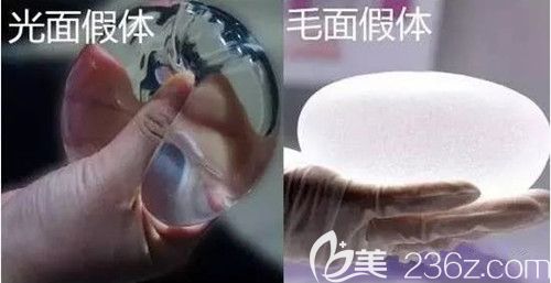假体隆胸分为光面和毛面 假体隆胸分为光面和毛面