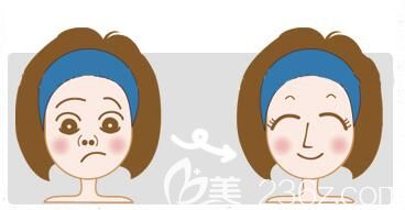 隆鼻后容易感染吗? 隆鼻后容易感染吗?