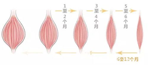 注射瘦脸维持时间较久
