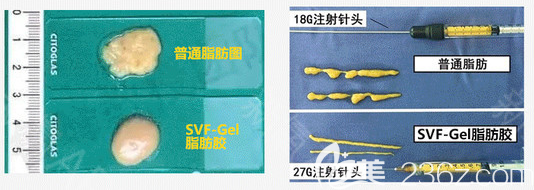 SVF-Gel脂肪胶和普通脂肪对比图