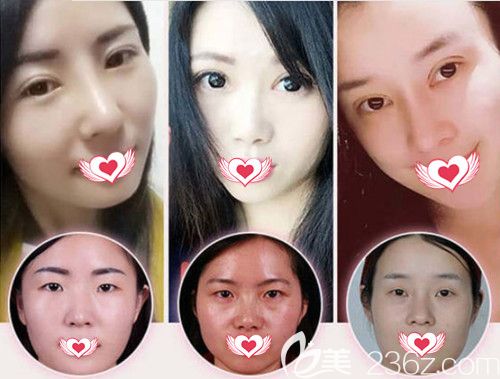 做双眼皮手术<span style=