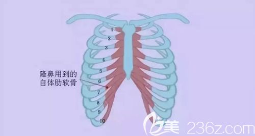 肋软骨取出位置介绍 肋软骨取出位置介绍