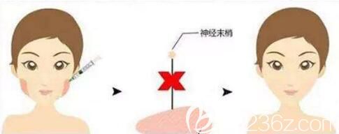 注射完瘦脸需要注意事项 注射完瘦脸需要注意事项